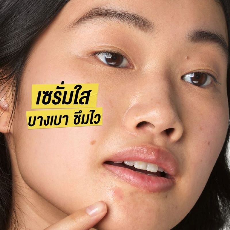 KIEHL'S Truly Targeted Blemish-Clearing Solution 15ml, Blemish-Clearing Solution , KIEHL'S เซรั่ม , เซรั่มแต้มสิว , Kiehl's Blemish Clearing Solution รีวิว , Kiehl's Truly Targeted acne-Clearing Solution รีวิว , Kiehl's สิว , Kiehl's สิว ราคา